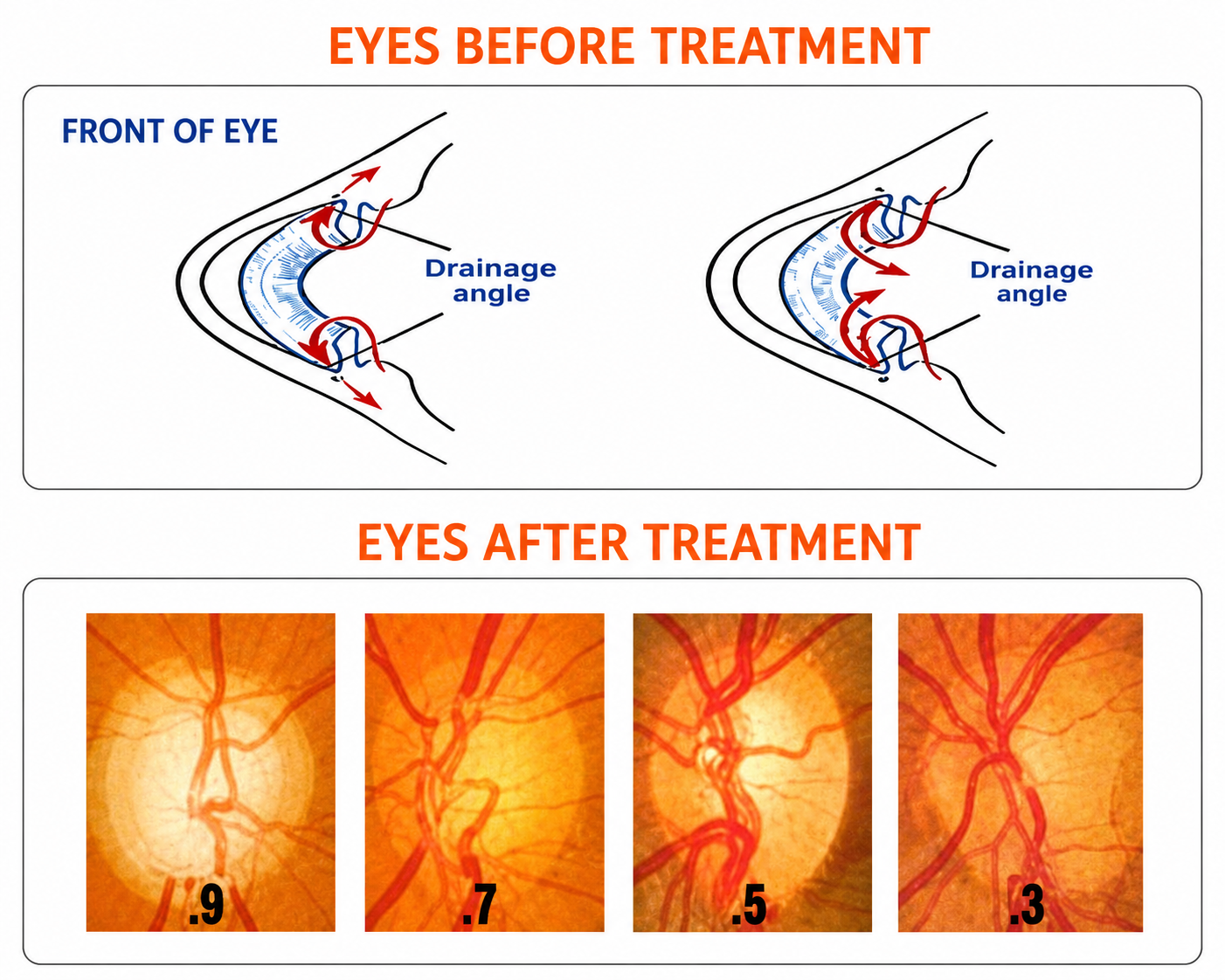 Isotine eye tonic for eye strain relief and general Ayurvedic eye care routines