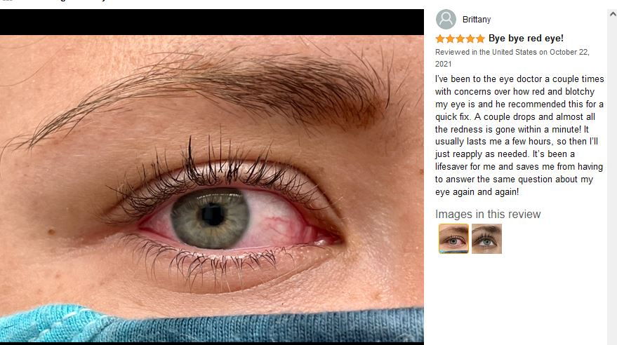 best over the counter eye drops for redness