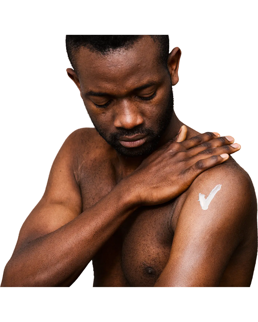 Applying moisturising cream to dry skin
